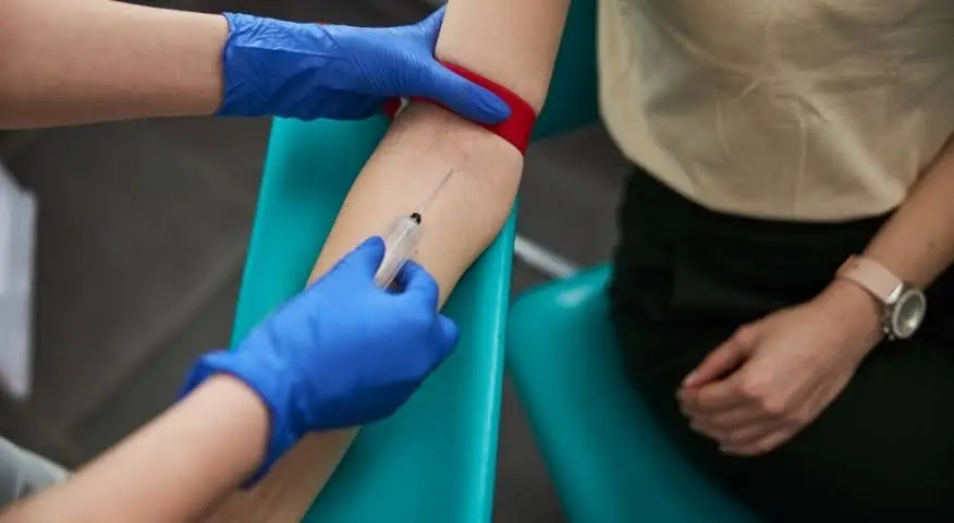 TSH Blood Test: What It Is, Procedure, Purpose & Levels